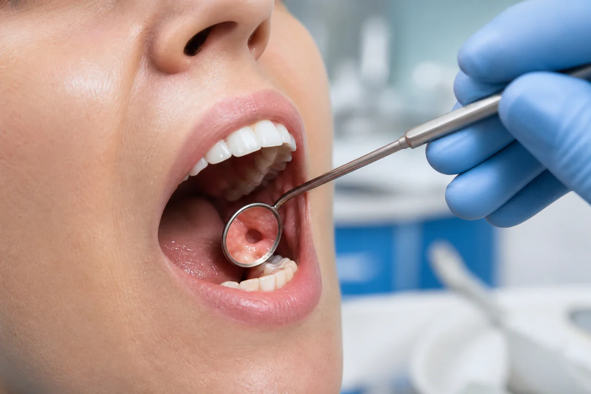 Extraction dentaire : trou qui ne se referme pas ?