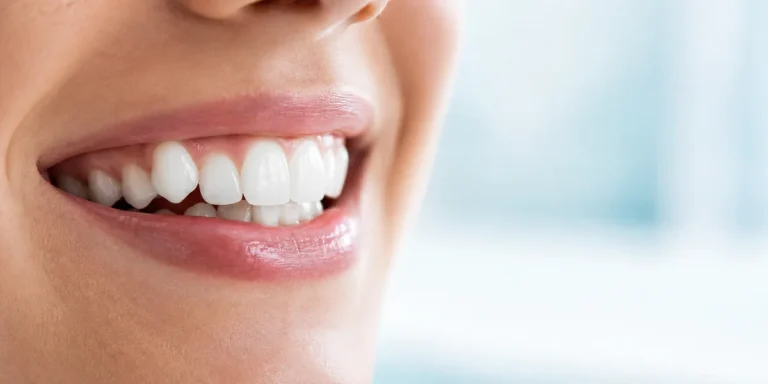 Chevauchement des dents : les solutions dépendent de l’âge et de l’espace