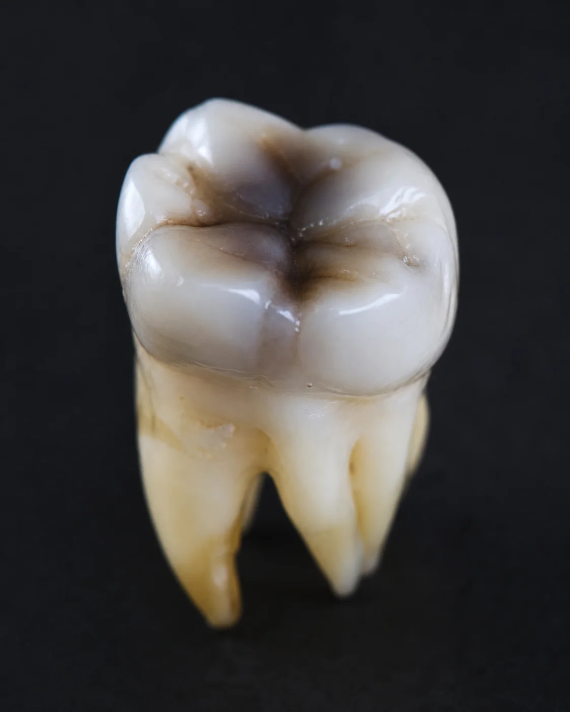Dent nécrosée et odeur persistante peuvent-elles révéler une infection ?